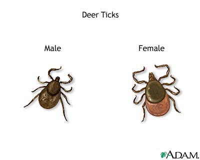Texas Warns Hunters About Fever Ticks