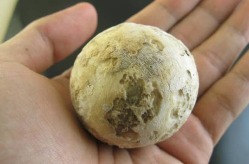 A mad stone removed from a ruminant animal, possibly a deer.